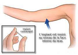 telechargement-6494037